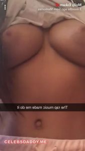 MOLLY ESKAM NUDE PRIVATE PHOTOS LEAKED